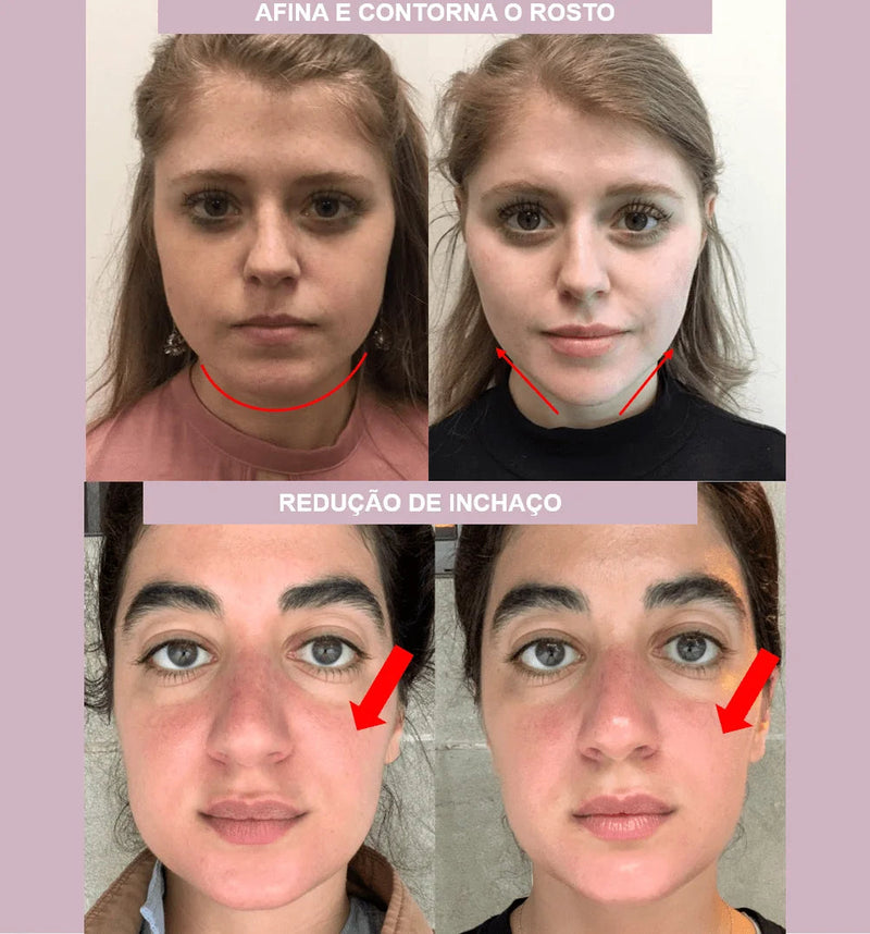 Máscara de Contorno Facial - Suaviza Rugas, Papada e Modela o Rosto